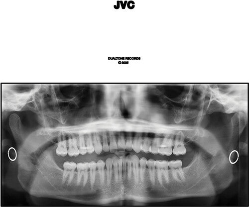 JVC