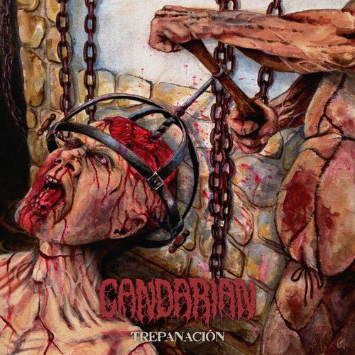 TREPANACION